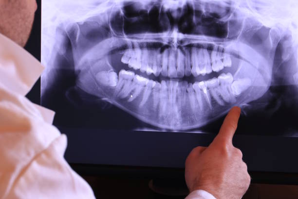 Best Tooth Pain Emergency Relief  in Brookfield Center, OH