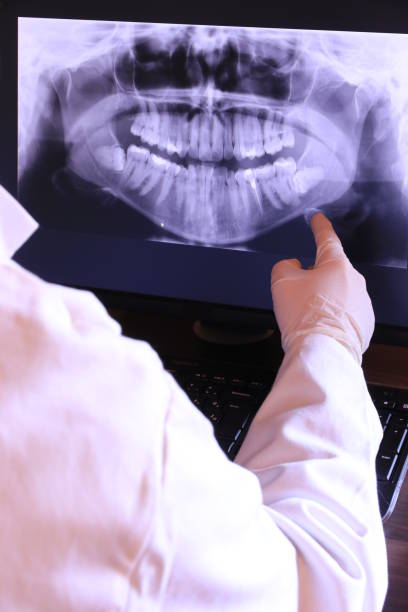Teeth Whitening in OH
