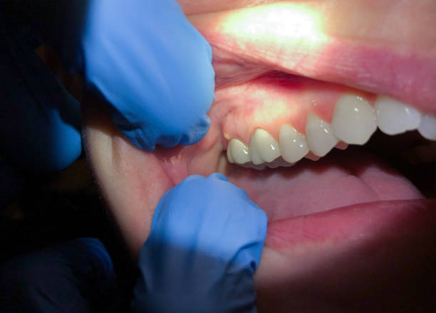 Best Walk-In Dentist Near Me  in Brookfield Center, OH