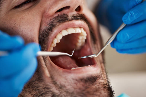 Best Emergency Dental Services Near Me  in Brookfield Center, OH