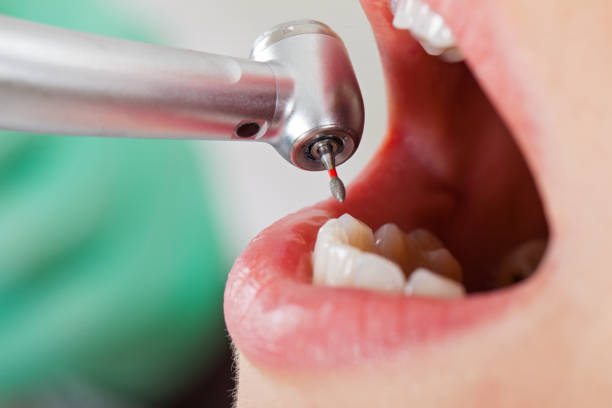 Best Dentist for Severe Toothache  in Brookfield Center, OH